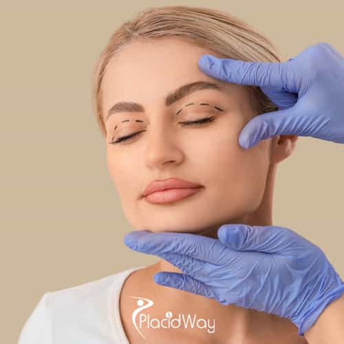 The Subtle Refresh: Why Guadalajara is the Go-To Hub for Quick-Recovery 'Fox Eye' and Eyelid Surgeries